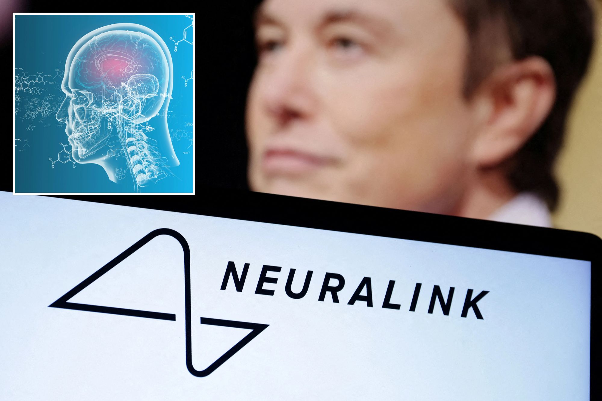 Emkerkísérleteket végeznek Elon Musk cégei